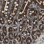 Immunohistochemical staining of human duodenum shows strong granular cytoplasmic positivity in glandular cells.