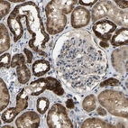 Immunohistochemical staining of human kidney shows moderate to strong granular cytoplasmic positivity in cells in tubules.