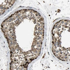 Immunohistochemical staining of human testis shows moderate to strong granular cytoplasmic positivity in cells in seminiferous ducts.