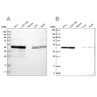 Western blot analysis using Anti-TUFM antibody HPA018991 (A) shows similar pattern to independent antibody HPA024087 (B).
