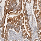 Anti-CYB5R4 Antibody