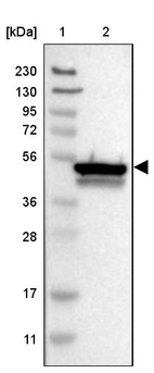 Lane 1: Marker [kDa] 230, 130, 95, 72, 56, 36, 28, 17, 11_br/_Lane 2: Human cell line RT-4