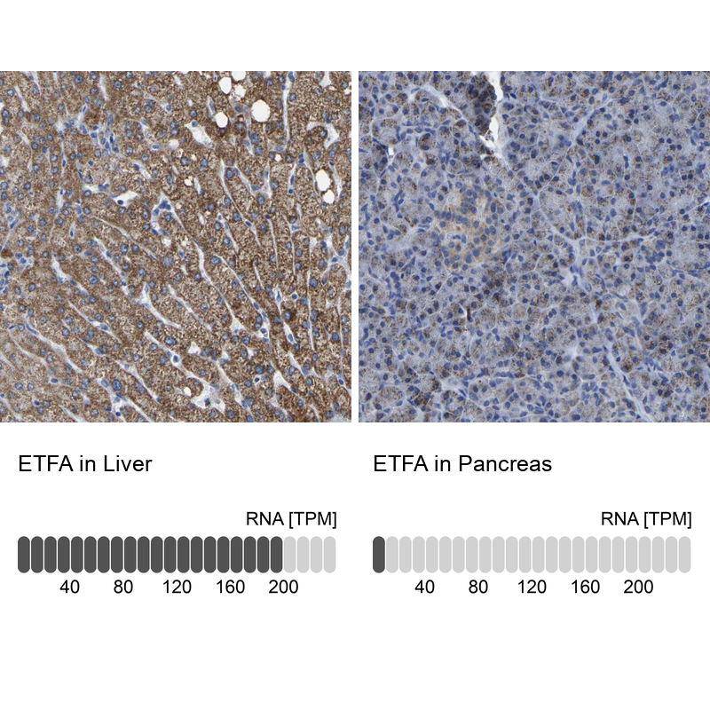 Anti-ETFA Antibody