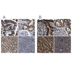 Immunohistochemical staining of human colon, kidney, liver and pancreas using Anti-ETFA antibody HPA018993 (A) shows similar protein distribution across tissues to independent antibody HPA018990 (B).