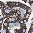 Immunohistochemical staining of human colon using Anti-ETFA antibody HPA018993.