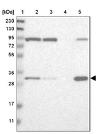 Lane 1: Marker [kDa] 230, 130, 95, 72, 56, 36, 28, 17, 11_br/_Lane 2: Human cell line RT-4_br/_Lane 3: Human cell line U-251MG sp_br/_Lane 4: Human plasma (IgG/HSA depleted)_br/_Lane 5: Human liver tissue