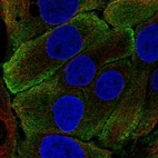 Immunofluorescent staining of human cell line HaCaT shows localization to plasma membrane.