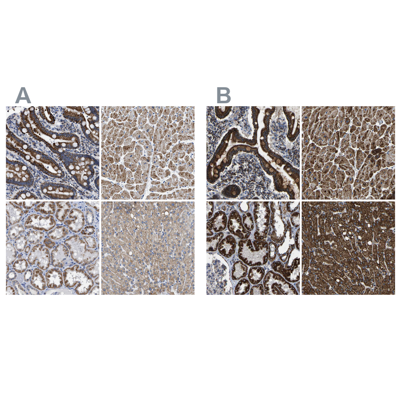 Anti-ETFA Antibody