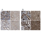 Anti-ETFA Antibody