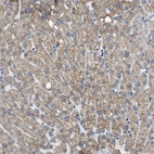 Immunohistochemical staining of human liver shows moderate granular cytoplasmic positivity in hepatocytes.