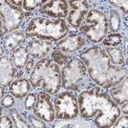 Immunohistochemical staining of human kidney shows moderate granular cytoplasmic positivity in cells in tubules.
