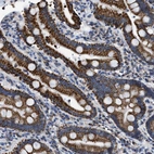 Immunohistochemical staining of human duodenum shows strong granular cytoplasmic positivity in glandular cells.