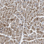 Immunohistochemical staining of human heart muscle shows moderate granular cytoplasmic positivity in cardiomyocytes.