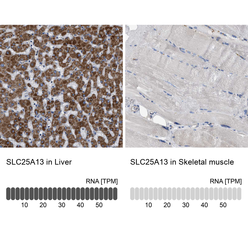 Anti-SLC25A13 Antibody
