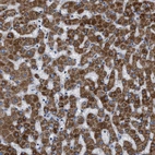 Immunohistochemical staining of human liver shows strong granular cytoplasmic positivity in hepatocytes.