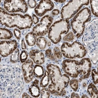 Immunohistochemical staining of human kidney shows strong granular cytoplasmic positivity in cells in tubules.