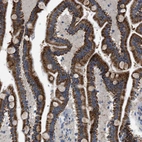 Immunohistochemical staining of human duodenum shows strong granular cytoplasmic positivity in glandular cells.
