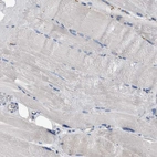 Immunohistochemical staining of human skeletal muscle shows no positivity in myocytes as expected.