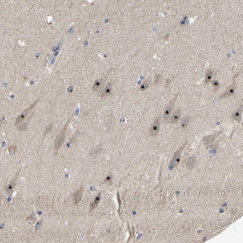 Anti-GLTSCR2 Antibody