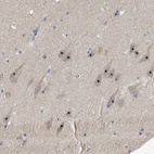 Anti-GLTSCR2 Antibody