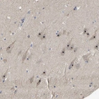 Anti-GLTSCR2 Antibody