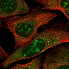 Immunofluorescent staining of human cell line U-2 OS shows positivity in nucleoli & vesicles.