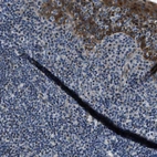 Immunohistochemical staining of human tonsil shows moderate cytoplasmic positivity in squamous epithelial cells.