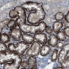 Immunohistochemical staining of human kidney shows strong cytoplasmic positivity in cells in proximal tubules.