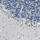 Immunohistochemical staining of human cerebellum shows weak cytoplasmic positivity in Purkinje cells as expected.