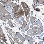 Immunohistochemical staining of human skeletal muscle shows moderate cytoplasmic positivity in myocytes.