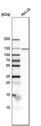 Western blot analysis in human cell line RH-30.