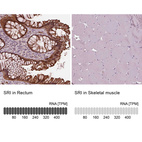 Anti-SRI Antibody