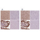 Anti-SRI Antibody