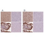 Immunohistochemical staining of human cerebral cortex, liver, rectum and skeletal muscle using Anti-SRI antibody HPA019004 (A) shows similar protein distribution across tissues to independent antibody HPA073666 (B).