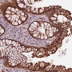 Immunohistochemical staining of human rectum shows strong cytoplasmic and membranous positivity in glandular cells.