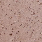 Immunohistochemical staining of human cerebral cortex shows strong cytoplasmic and membranous positivity in glial cells.