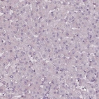 Immunohistochemical staining of human liver shows no cytoplasmic positivity in hepatocytes as expected.