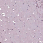 Immunohistochemical staining of human skeletal muscle shows no cytoplasmic positivity in myocytes as expected.