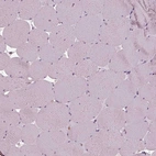 Immunohistochemical staining of human skeletal muscle shows no cytoplasmic positivity in myocytes as expected.