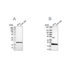 Anti-SRI Antibody