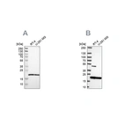 Western blot analysis using Anti-SRI antibody HPA019004 (A) shows similar pattern to independent antibody HPA073666 (B).