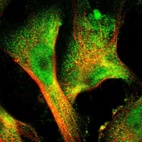 Immunofluorescent staining of human cell line U-251 MG shows localization to nucleoplasm & cytosol.