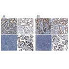 Anti-ACADVL Antibody