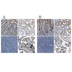 Immunohistochemical staining of human duodenum, kidney, lymph node and placenta using Anti-ACADVL antibody HPA019006 (A) shows similar protein distribution across tissues to independent antibody HPA020595 (B).