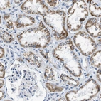 Immunohistochemical staining of human kidney shows moderate cytoplasmic positivity in cells in tubules.