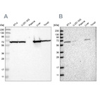 Anti-ACADVL Antibody