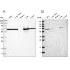 Western blot analysis using Anti-ACADVL antibody HPA019006 (A) shows similar pattern to independent antibody HPA020595 (B).