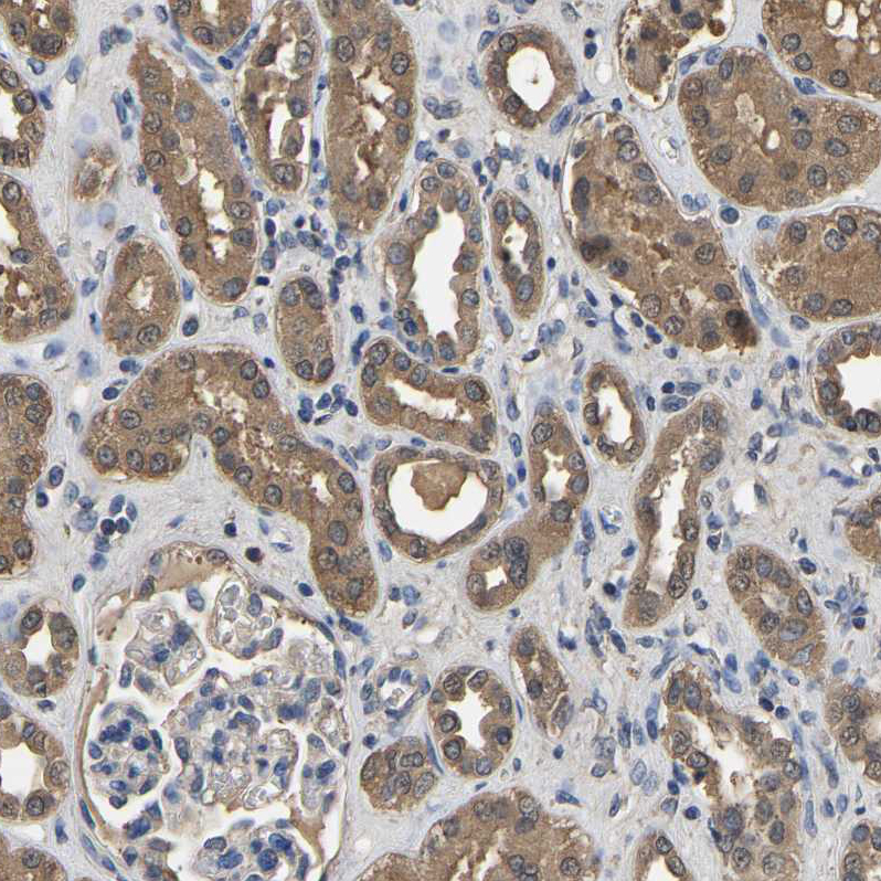 Anti-LDHB Antibody