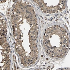 Immunohistochemical staining of human testis shows moderate cytoplasmic positivity in cells in seminiferous ducts.