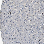 Immunohistochemical staining of human liver shows no positivity in hepatocytes as expected.